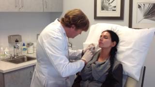 RADIESSE cheek and smile line filler at MBody Vienna (Tysons Corner) Northern Virginia