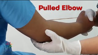 Pulled elbow