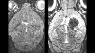 Correlated magnetic resonance imaging and ultramicroscopy (MR-UM) is a tool kit to assess