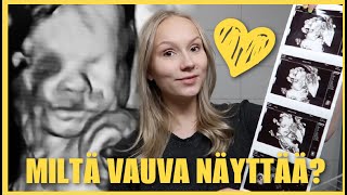 ULTRASSA vauvaa katsomassa👶 | mai day