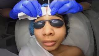 Customized Facial Treatment NYC