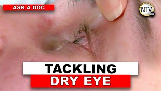 Ask A Doc: Tackling dry eye