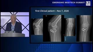 John Barrett, Founder \u0026 CEO at ZKR Orthopedics || LSI 2021 Emerging Medtech Summit