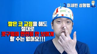 짧은 코 교정을 해도 절대로 콧구멍이 완전히 안 보이게 할 수는 없어요!!!