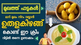 Potato Cream for Skin Brightening | SimpleTips Malayalam