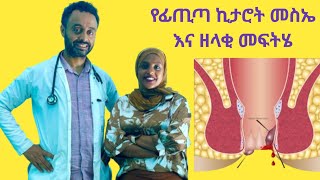 የፊጢጣ ኪታሮት ከ ኦፕሬሽን ውጭ ያለ ዘላቂ መፍትሄ በ ባህል ይሻላል? ወይስ በ ህክምና hemmoroide|