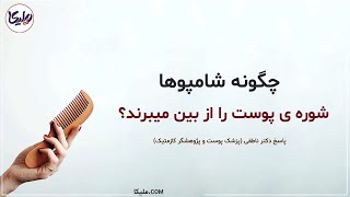 علت ایجاد و درمان شوره سر