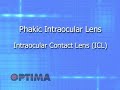 Phakic Intraocular Lens – Intraocular Contact Lens ICL