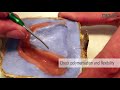 how to prepare a long term denture relining with molloplast® b