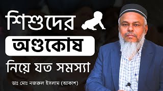 শিশুর অণ্ডকোষ নিয়ে যত সমস্যা - Dr. Nazrul Islam Akash |  অন্ডকোষ রোগের চিকিৎসা  Testicle Disease