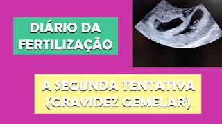 DIÁRIO DA FERTILIZAÇÃO 3/3 - SEGUNDA TENTATIVA E MINHA GRAVIDEZ GEMELAR