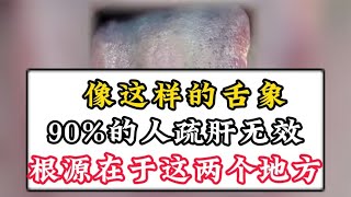 像这样的舌象，90%的人疏肝无效，根源就在于这两个地方不通！