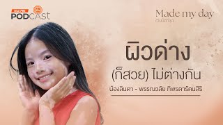 ผิวด่าง (ก็สวย) ไม่ต่างกัน - น้องรินดา พรรณวลัย ทิพรดารัตนสิริ | Made My Day วันนี้ดีที่สุด