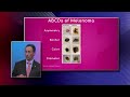 ABCDs of Melanoma