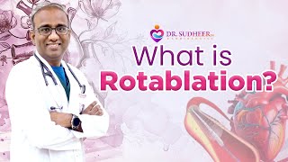 What is Rotablation? Dr Sudheer Koganti