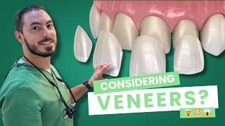 Dental Veneers Procedure Explained | Everything You NEED to Know