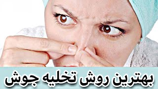 بهترین روش برای تخلیه جوش   باید ها و نباید ها