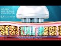 Anti-Aging, Skin Tightening , Wrinkle Reduction - Venus Freeze Plus (3D Medical Animation 2020)