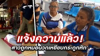 แจ้งความแล้ว! สาวถูกหมอนวดเหยียบกระดูกหัก | ข่าวช่องวัน | one31