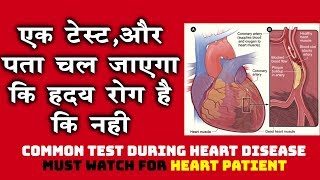 ह्रदय रोग में किये जाने वाले टेस्ट, पता चल जायेगा की ह्रदय रोग है की नहीं Diagnosis in Heart Disease