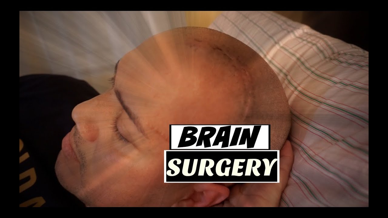 Surviving Brain Surgery Youtube