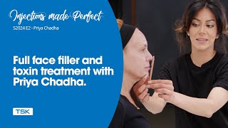 Full face filler and toxin treatment with Dr Priya Chadha.