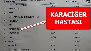 KARACİĞER HASTASININ TİPİK KAN TAHLİLİ SONUCU!