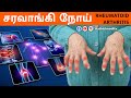 சரவாங்கி என்ற முடக்கு வாதம் | Rheumatoid Arthritis Symptoms, Causes and Treatment | Saravaangi