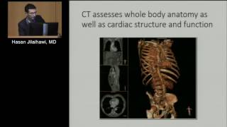 CT Assessment of Native Valve Function: Ready for Primetime? (Hasan Jilaihawi, MD)