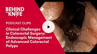 Clinical Challenges in Colorectal Surgery: Endoscopic Management of Advanced Colorectal Polyps