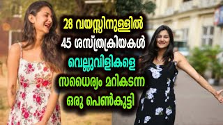 28 വയസ്സിനുള്ളില്‍ 45 ശസ്ത്രക്രിയകള്‍ വെല്ലുവിളികളെ സധൈര്യം മറികടന്ന ഒരു പെണ്‍കുട്ടി !!!