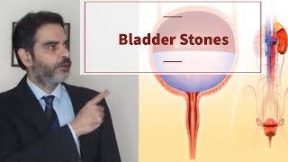 Urinary Bladder Stone In Hindi | यूरिनरी ब्लैडर स्टोन हिंदी में
