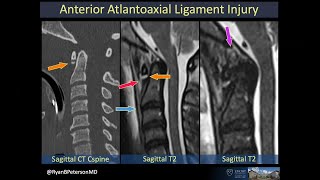 Trauma: Beyond the Basics - Neuroradiology Longitudinal Course Sample