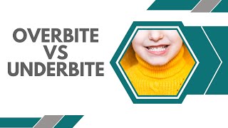 Overbite vs Underbite: Complete differences \u0026 5 usual causes