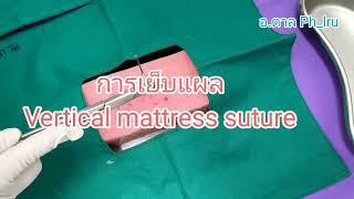 taan phlru การเย็บแผลแบบ vertical mattress suture