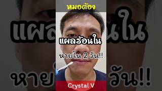 วิธีทาแผลร้อนใน ที่ถูกวิธี หายใน 2 วัน #ร้อนใน #แผลร้อนใน