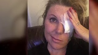 VIDEO: What is Bell's palsy? Symptoms, treatment and recovery