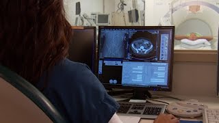 Seeing Cancer Sooner with CT Lung Scans - Mayo Clinic