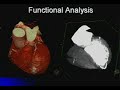 Non Coronary Artery Applications of Cardiac CT