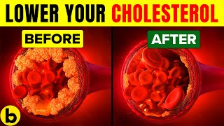 SAVE YOUR LIFE By Eating These 8 Foods That Can Lower Your Cholesterol Level