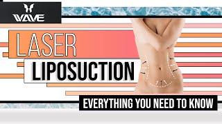 New Laser Liposuction Procedure | Smart Lipo - The New Way Of Getting Liposuction