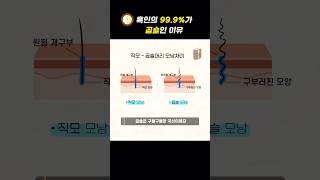 흑인의 99.9%가 곱슬인 이유