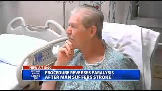 Stroke signs miraculously reversed in local man using new technology