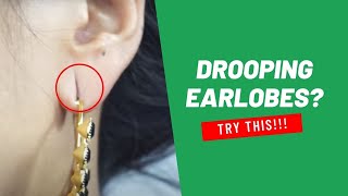 How to Shrink Drooping Earlobes Naturally - 5 Easy & Effective Home Remedies!