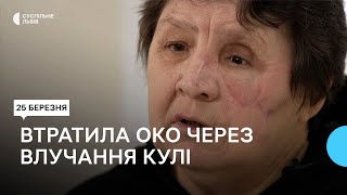 Відновлюють обличчя жінки, у яку влучила російська куля