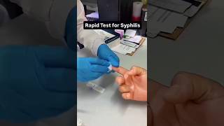 Rapid test Syphilis🩸#medicallife #motivation #ytshorts #ytstudio #labtechnician #motivation #rapid