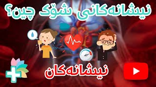 نیشانەکانی شۆک چین ؟ - نیشانەکان