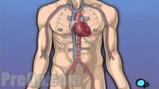 Coronary Artery Bypass Graft (CABG) Heart Surgery PreOp® Patient Education Medical video