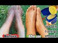 how I Cleared My Leg Wrinkles & Damage leg | To Get clear brighter smooth younger looking soft leg