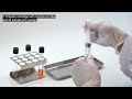 bactester sample preparation solids